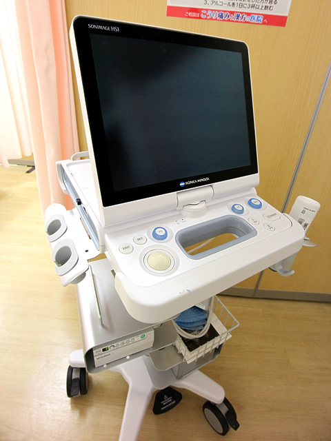 超音波診断装置